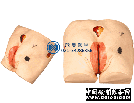 褥瘡護理模型整體結構